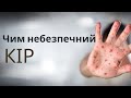 Кір. Що це за хвороба? Вакцинація від кору | Ранок надії | телеканал Надія