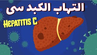 Hepatitis C التهاب الكبد سی