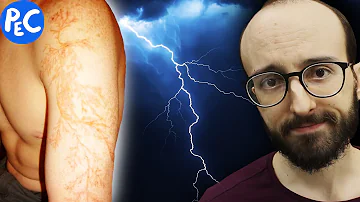 O que acontece se vc for atingido por um raio?