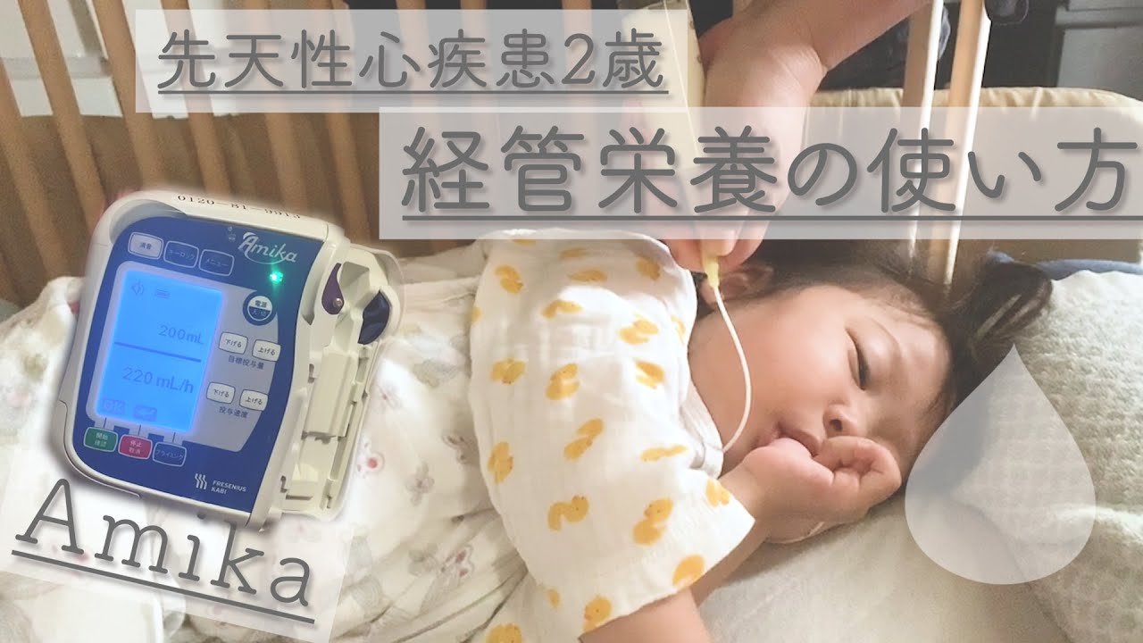 医療ケア児 2歳 経管栄養チューブ交換の様子 辛いけどもうすぐ卒業 娘の闘病記録 Youtube