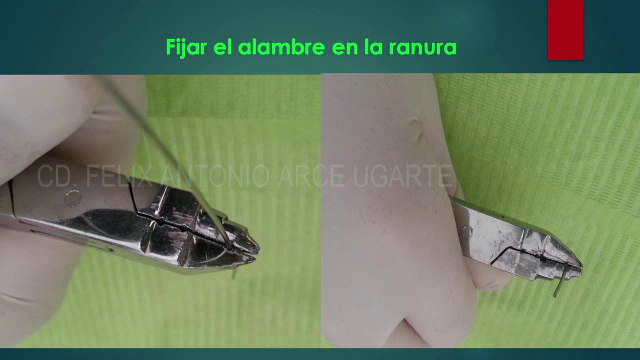 Principios básicos para hacer dobleces de alambre en ortodoncia