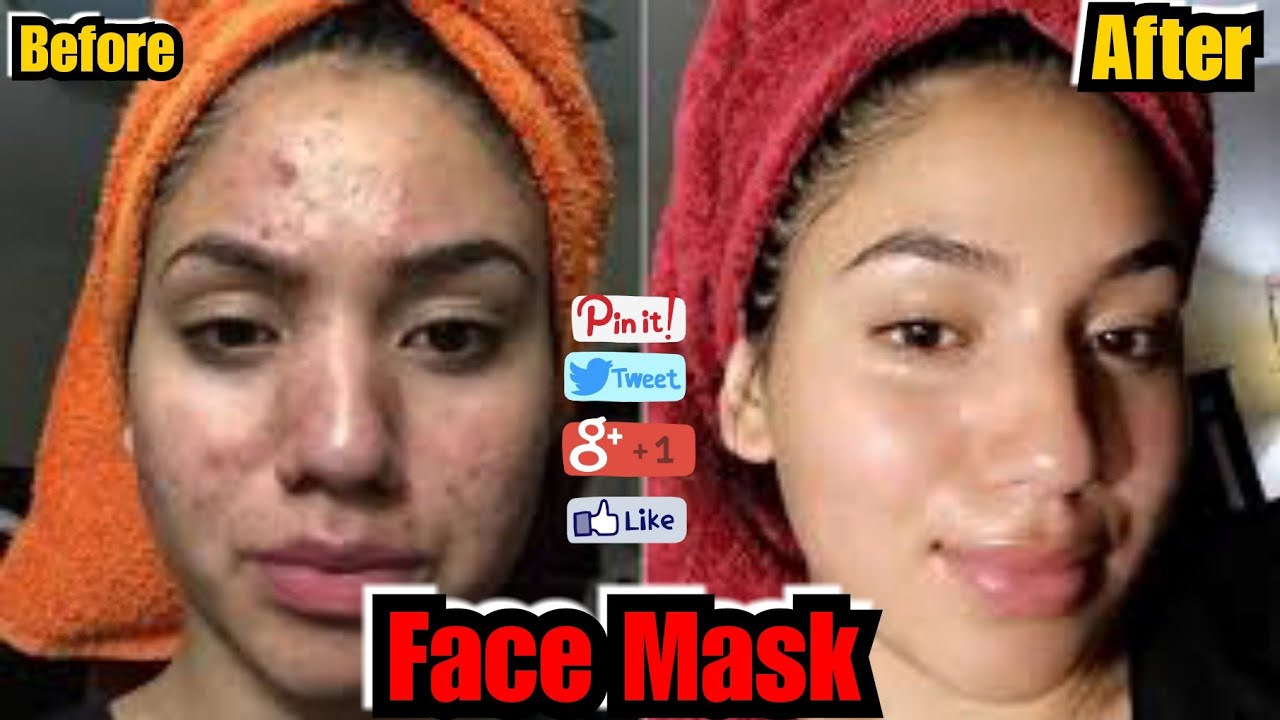 FacE Mask For Oily/Acne Prone Skin Controle Oil& Unclog Pores YouTube