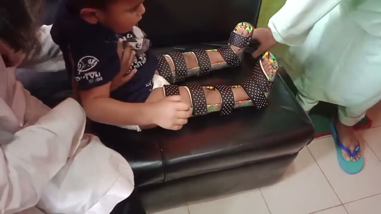 বাচ্চাদের kafo জুতা লাগানোর পদ্ধতি, বাঁকা পা সোজা করার জুতা ✆ 01644511819