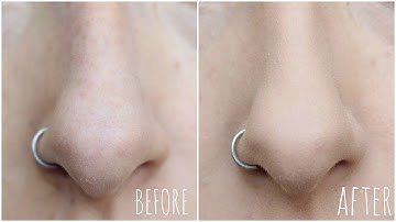 Makeup mishaps: How to stop foundation rubbing off your nose | Dramaticmac
