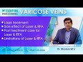 Success Rate and side affects of Laser Surgery for Varicose Veins by Dr. Bhaskar M V