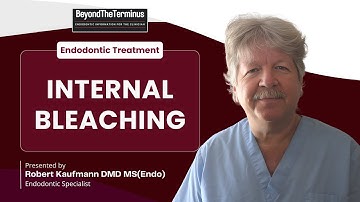 Internal Bleaching After Endodontics: Safe Techniques & Real Results