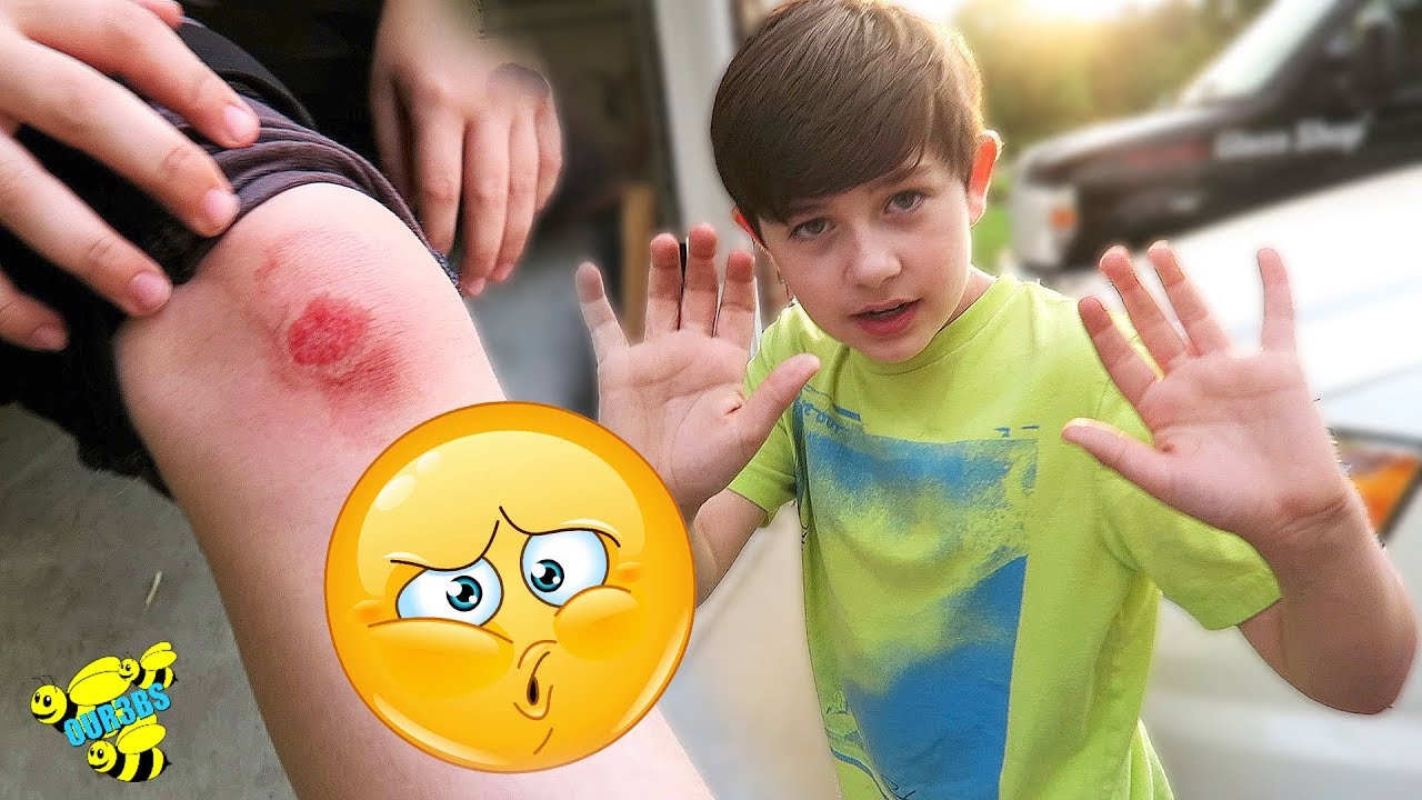 He Fell Off His Scooter :( - YouTube