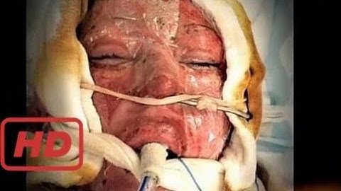 Khám Phá Thế Giới |  Đánh ghen: Cô gái chịu đựng bộ mặt quỷ sau lớp mặt nạ suốt 2 năm