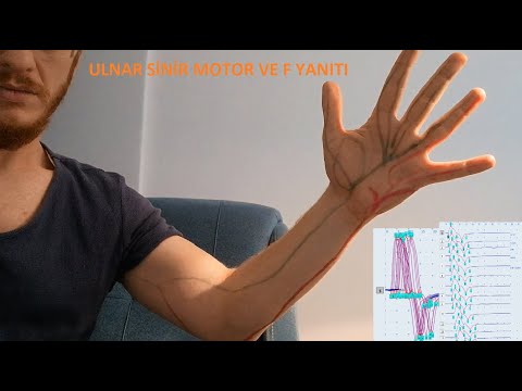 ANLATIMLI ULNAR SİNİR. MOTOR YANITLARI