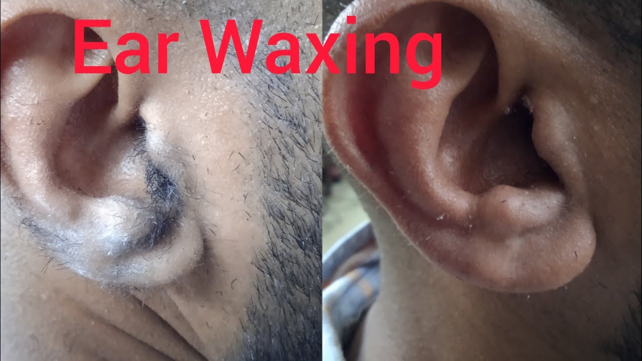 Ear Waxing / ഇയർ വാക്സിങ് 9747588080 YouTube