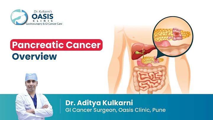 Pancreatic Cancer Overview | Dr. Aditya Kulkarni | Oasis Clinic