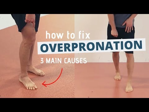 Video: Pronatieproblemen - Hoe geprononceerde voeten te repareren?