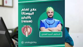 Rezum Water Vapour Therapy For The Prostate علاج الريزيوم لتضخم البروستاتا