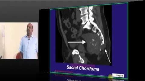 NEETPG Coaching Orthopedics Topic 01 Bone tumors Part 01