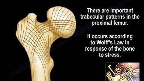 Trabecular Pattern of the Proximal Femur - Everything You Need To Know - Dr. Nabil Ebraheim