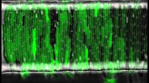 Microscopy fluorescence imaging of bacteria colony in microfluidics device