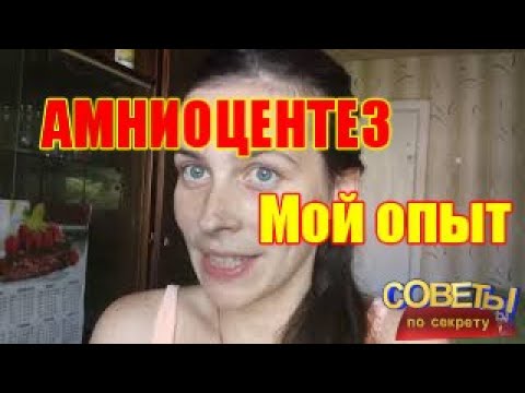 СТОИТ ЛИ ДЕЛАТЬ АМНИОЦЕНТЕЗ  Как делают АМНИОЦЕНТЕЗ   Мой опыт