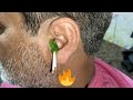 Wax hair removal 💥 for Men 2024
