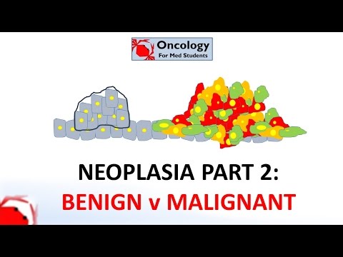 2. Neoplasia part 2: Differences between benign and malignant neoplasms