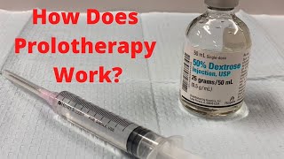 How Does Prolotherapy Work? Prolotherapy Explained.