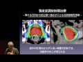 前立腺がんの放射線治療～IMRT、粒子線治療、小線源治療　秋元 哲夫