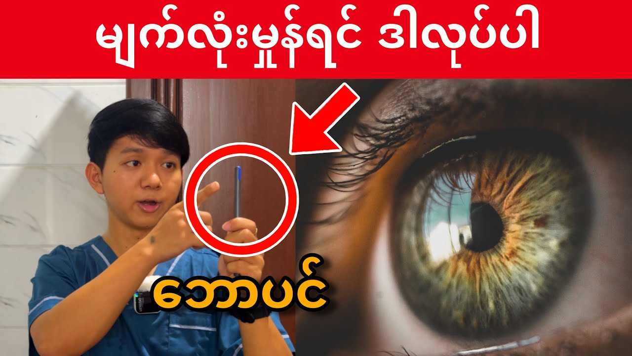 ဘောပင်တစ်ချောင်းတည်းနဲ့ အမြင်အာရုံအားကောင်းလာစေမယ့် လေ့ကျင့်ခန်း (၂) ခု