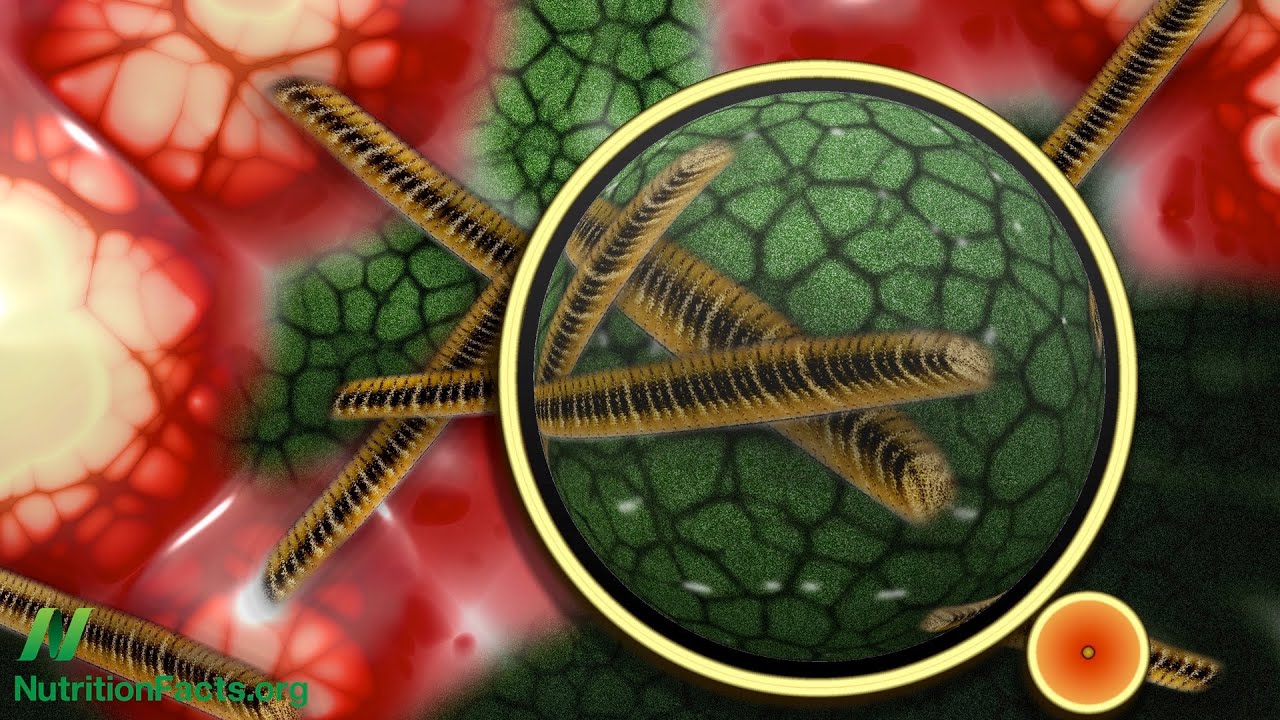 What’s Your Gut Microbiome Enterotype? - YouTube