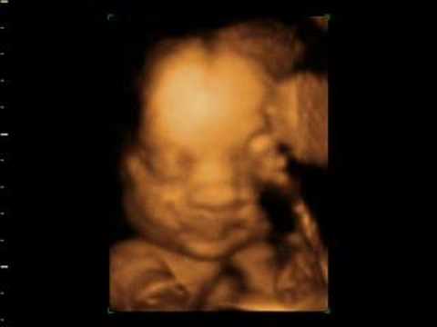 gary cahill 4d baby scan of louise and gary