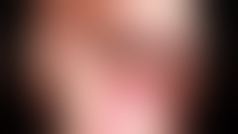 Endoscopic Trigeminal Neuralgia Surgery - Skull Base Institute