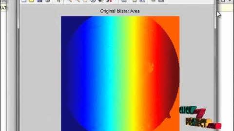 Final Year Projects | Textureless Macula Swelling Detection With Multiple Retinal Fundus Images