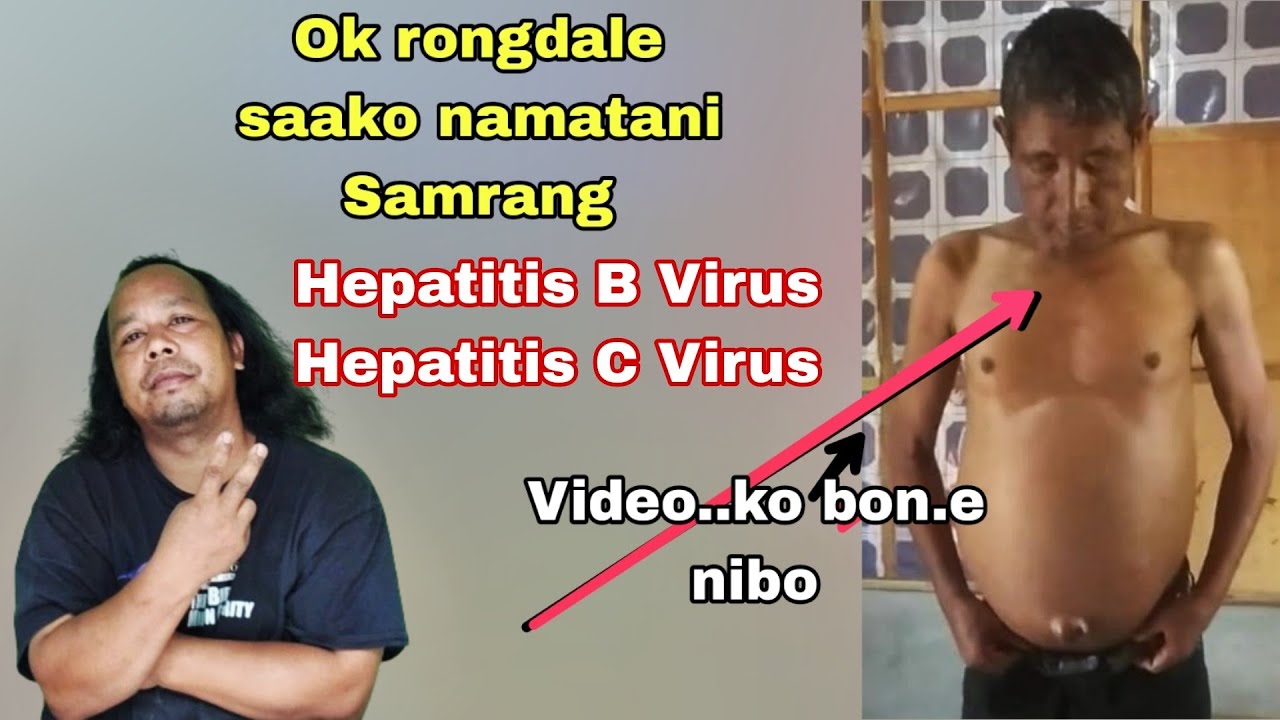 Ok rongdale saako namatna man.aia./// Ia video..ko bon.e nibo talataniko name knabo.