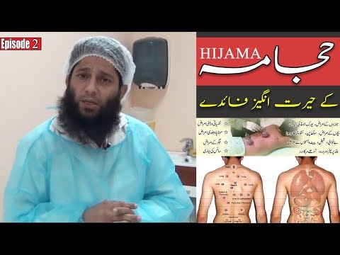 Amazing Benefits of Hijama - Cupping Therapy | Dr Iftkhar Saifi | حجامہ کے حیرت انگیز فائدے