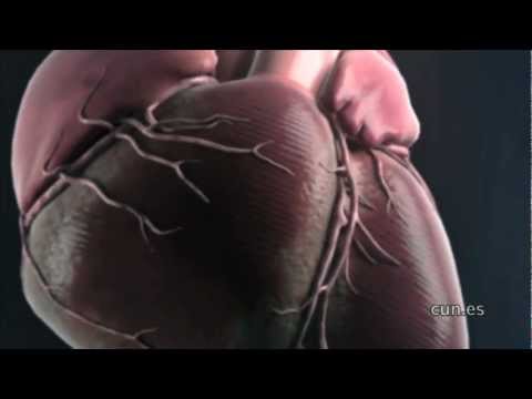 Vídeo: 13 Remedios Caseros Para El Dolor Cardíaco