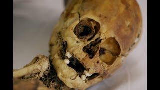 The Skull That Defies Explanation