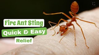 Fire Ant Sting Relief: How to Treat and Soothe the Pain - Quick & Easy | The Guardians Choice