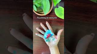 The struggle of sweaty hands (hyperhidrosis) 💧