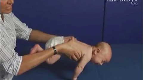 2 Month Old Babies Typical and Atypical Development in Protective Extension (defensive response)