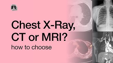 Chest X-Ray, CT, or MRI?