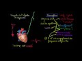 Ecg et diagnostic de linfarctus du myocarde crise cardiaque