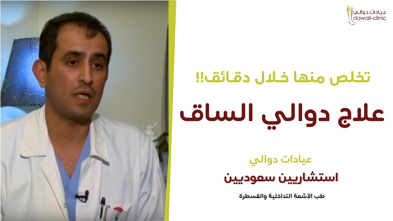 علاج دوالي الساقين بدون جراحة بسهولة مع أطباء استشاريين سعوديين Youtube