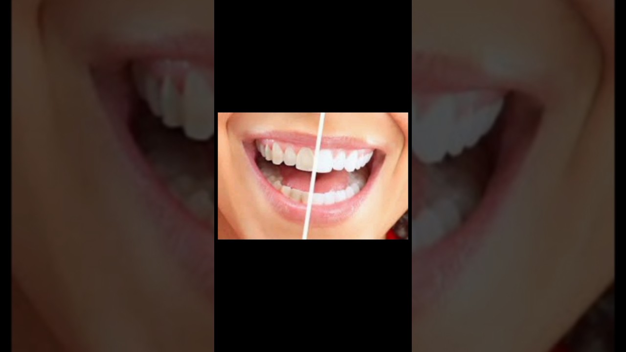 "Ajwain: Sehat ka Khazana | Amazing Benefits"| naintara health