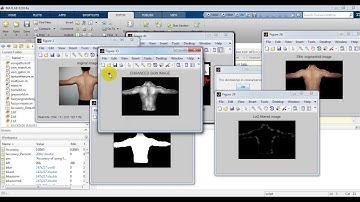On Criminal Identification in Color Skin Images Using Skin Marks and Fusion with Vein Patterns