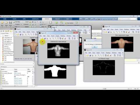 On Criminal Identification in Color Skin Images Using Skin Marks and Fusion with Vein Patterns