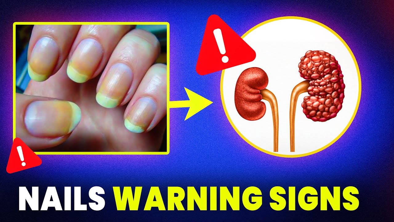 9 Nail Changes That Could Reveal Serious Health Problems | Nail Signs You Shouldn't Ignore