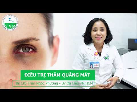 Video: 3 cách điều trị mắt đen