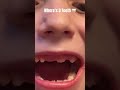 Jaydon’s Third Loose Tooth 🤣 Can I Wiggle Three Tooth 🦷 Dec 18, Feb 11, May 19