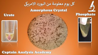 E7. Amorphous crystal  كل ما يخص الأملاح الرمليه وانواعها وكيفية التميز Amorphous Urates