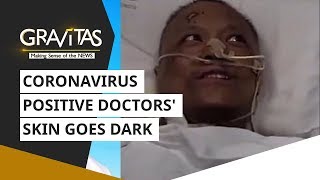 Wuhan: Coronavirus positive doctors' skin goes dark after treatment | Gravitas