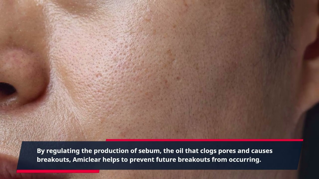 “Unlock Radiant Skin with Amiclear Beauty Secrets: Natural Solutions for Clear, Glowing Resul