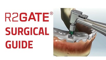 R2GATE Surgical Guide and Prefabricated Prosthetics